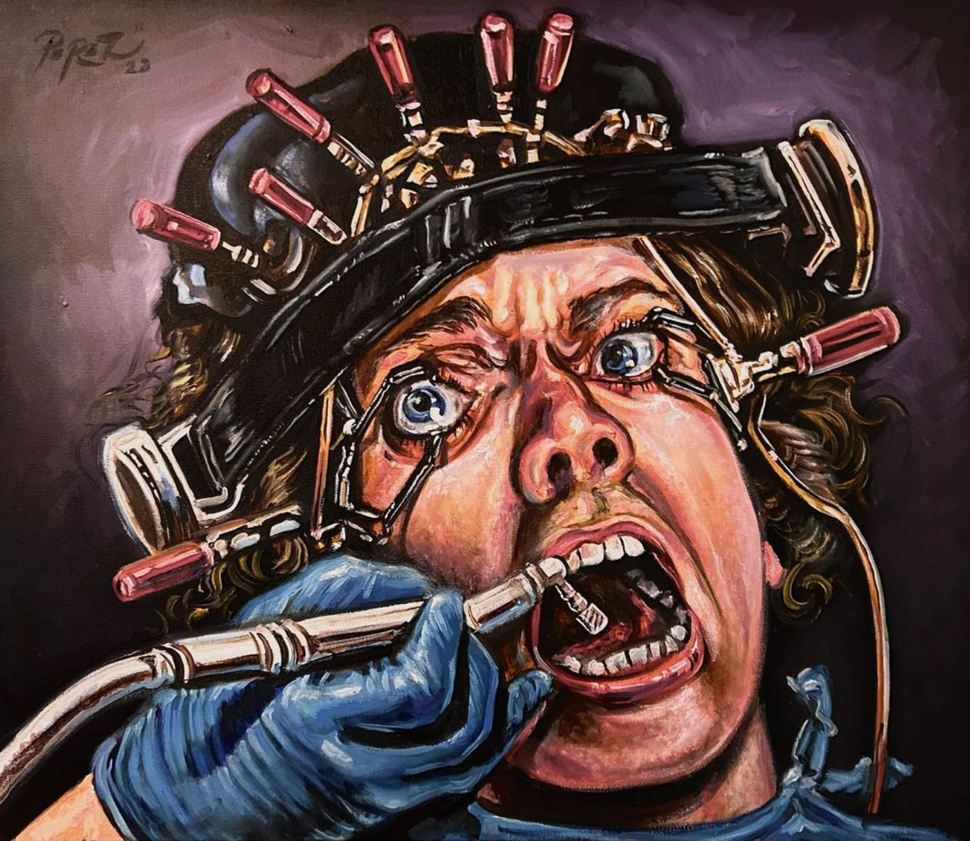 (A Clockwork Orange) Alex DeLarge at the dentist 🦷